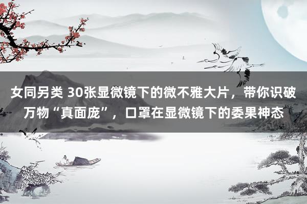 女同另类 30张显微镜下的微不雅大片,带你识破万物“真面庞”,口罩在显微镜下的委果神态